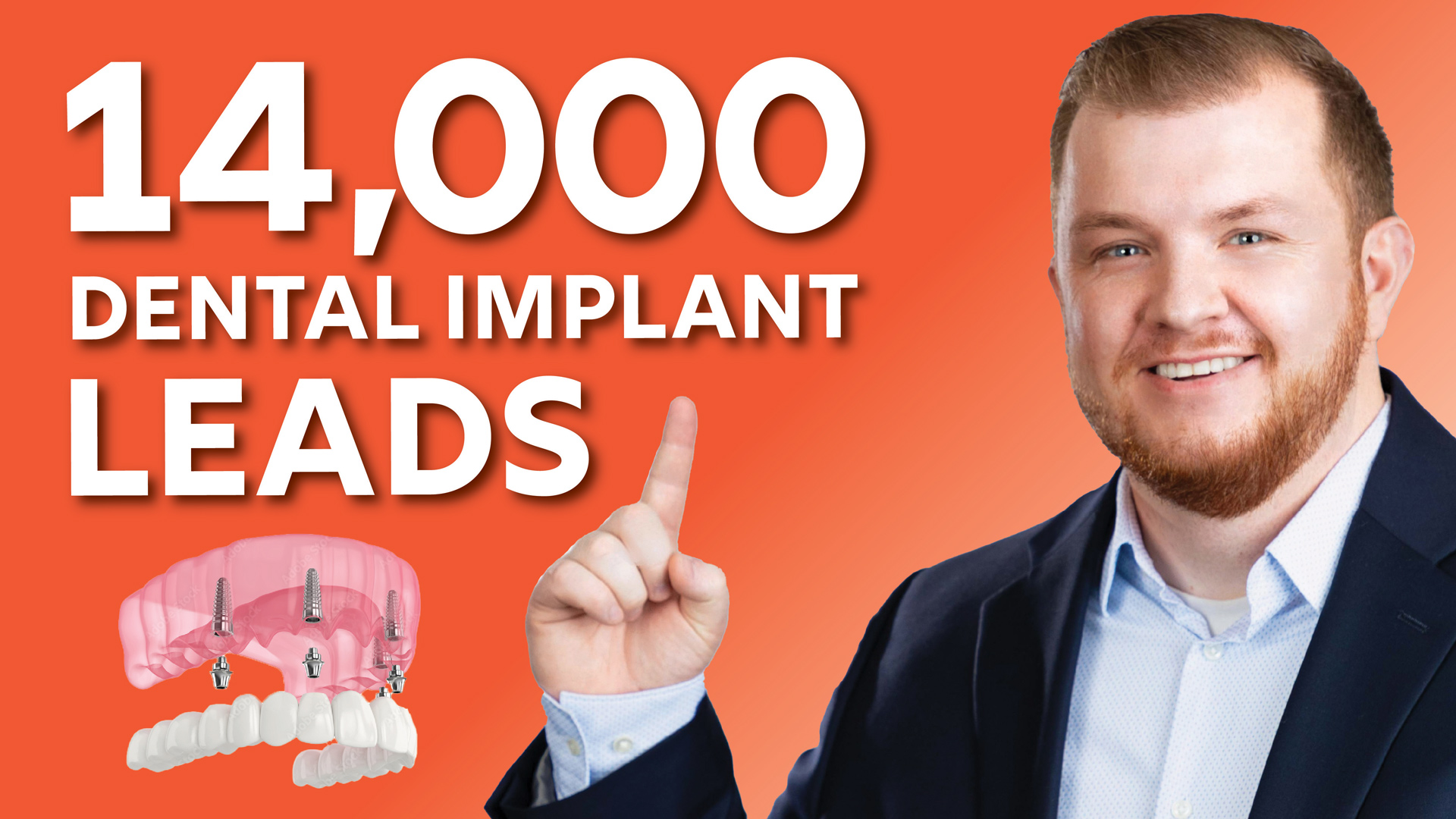 Best Dental Implant Marketing Agency